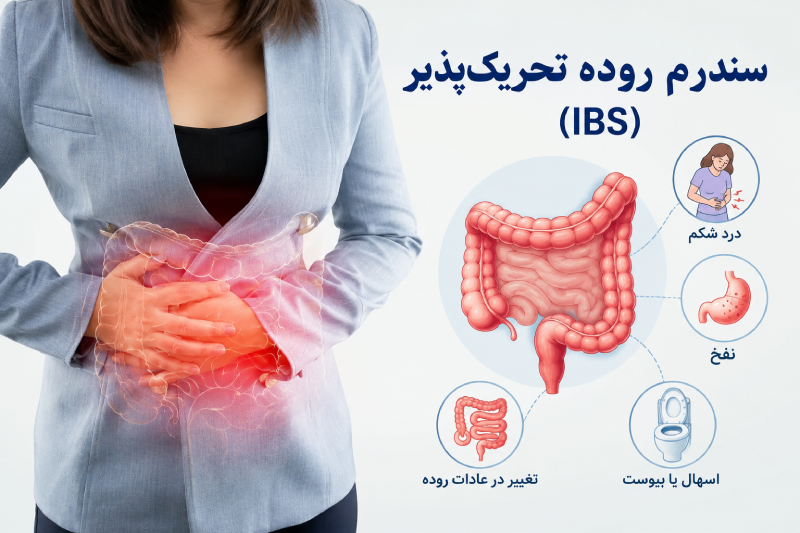 سندرم روده تحریک‌پذیر چیست؟